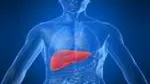Nafld