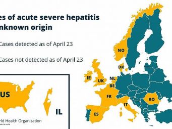 Najnovije informacije o trenutnoj epidemiji hepatitisa u djece