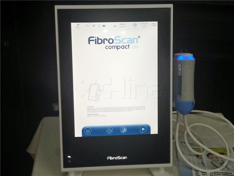 FibroScan