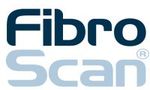 fibroscan